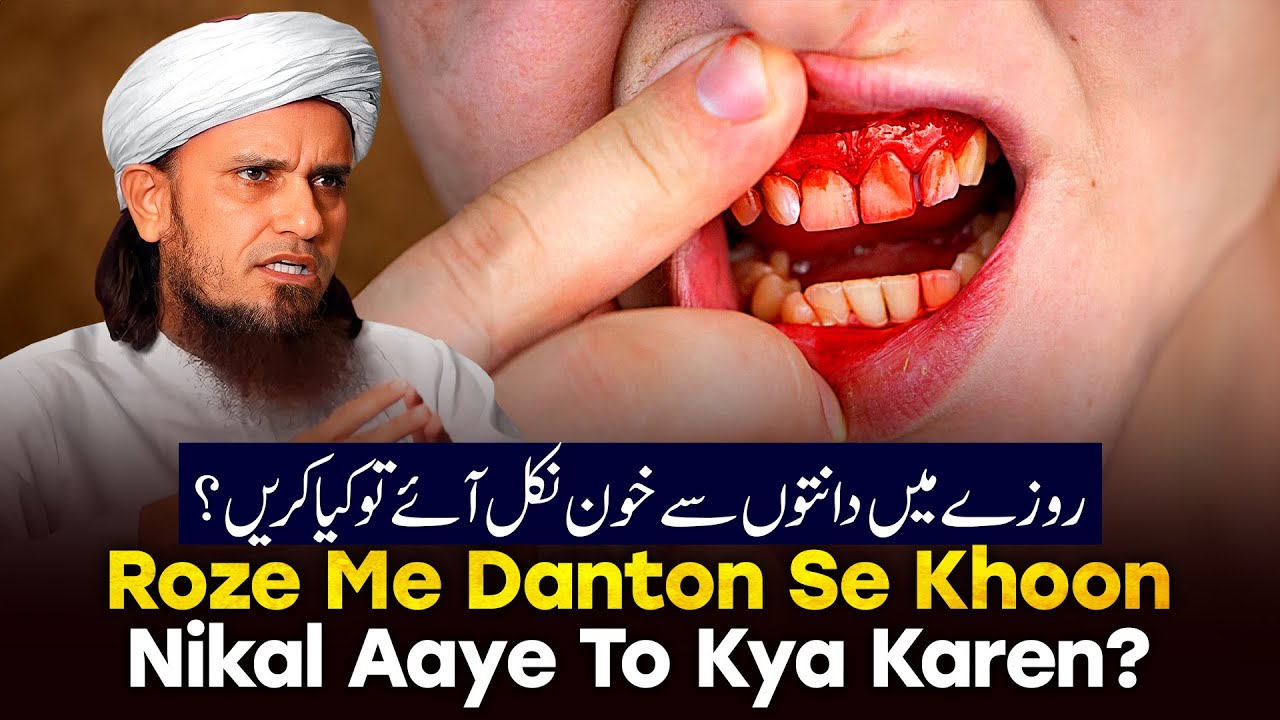 Roje Me Daato Se Khun Nikal Aaye Toh Kya Karen